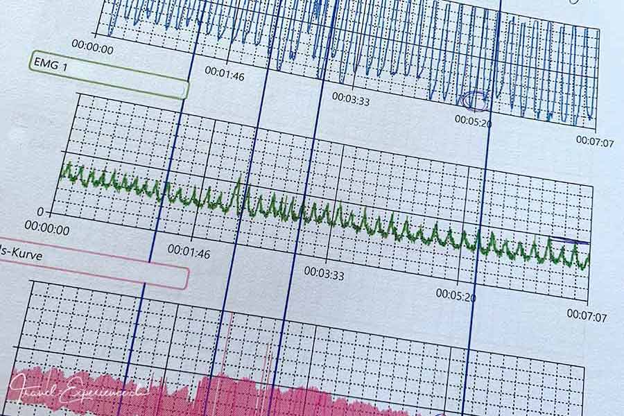 Detail, Beispiel einer Biofeedback-Messung